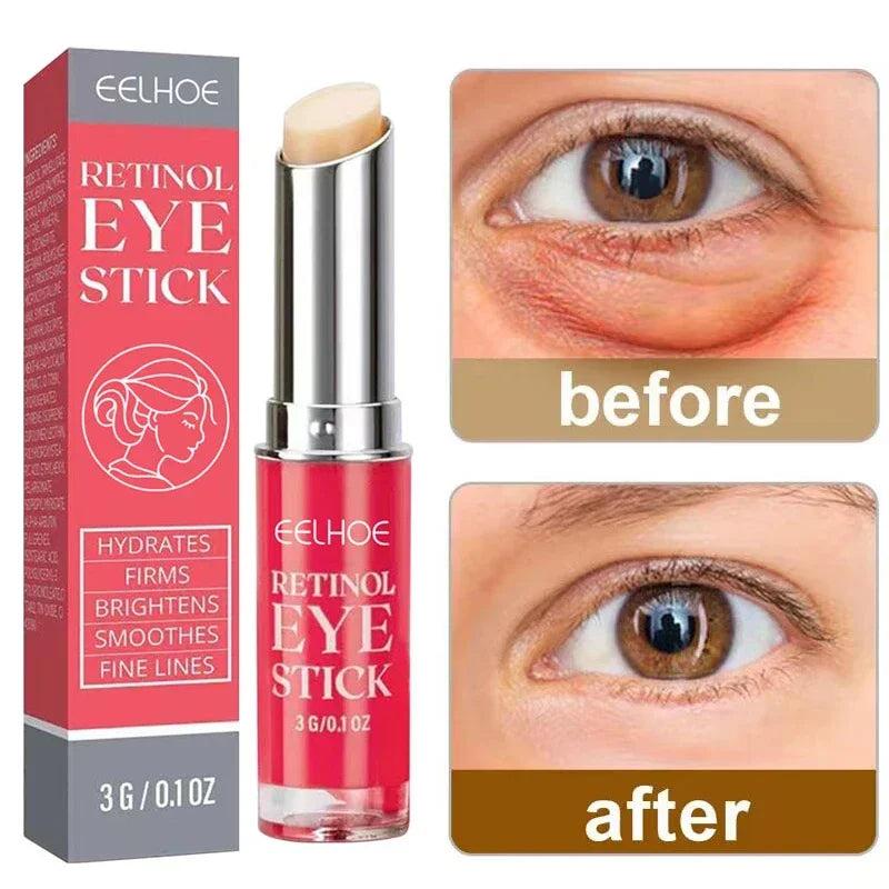 Anti-Wrinkle Retinol Eye Cream - Dark Circle Puffiness Reducer Firming Brightening Moisturizer - ZOOMNSTORE