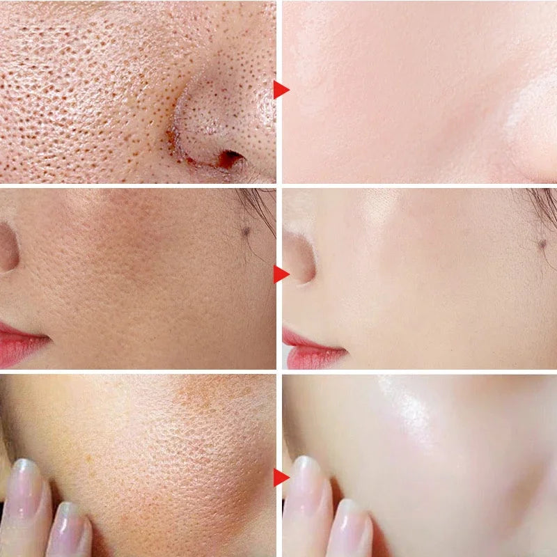 Dimollaure Face Cream - Moisturizing Anti-Aging Skin Care - ZOOMNSTORE