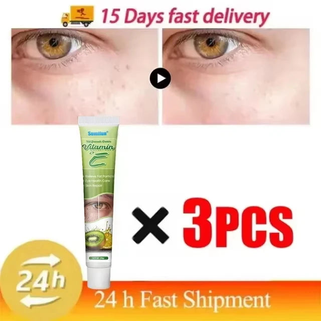 Eye Cream for Fat Granules Puffiness - Milia Remover Skin Repair - ZOOMNSTORE