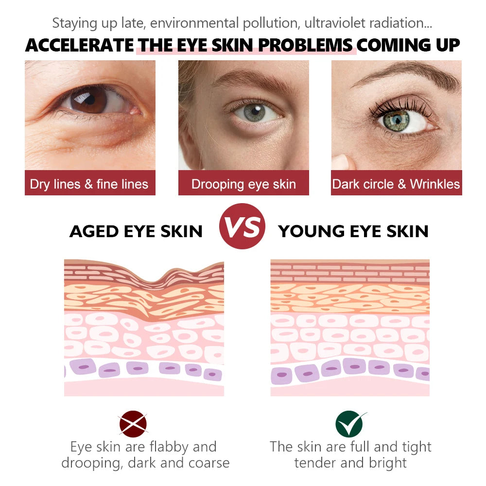 Retinol Eye Serum - Anti-Wrinkle Dark Circle Remover Brightening Moisturizer - ZOOMNSTORE