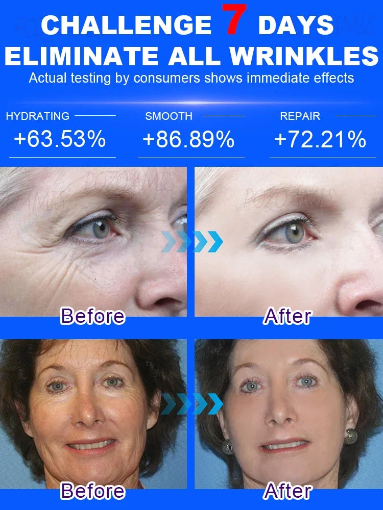 Wrinkle-Reducing Beauty Serum - Best Choice for Beauty Lovers - ZOOMNSTORE