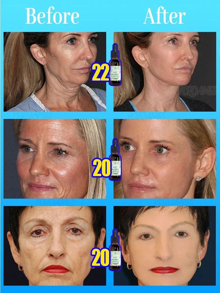Wrinkle-Reducing Beauty Serum - Best Choice for Beauty Lovers - ZOOMNSTORE
