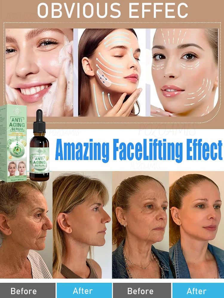 Wrinkle-Reducing Beauty Serum - Best Choice for Beauty Lovers - ZOOMNSTORE