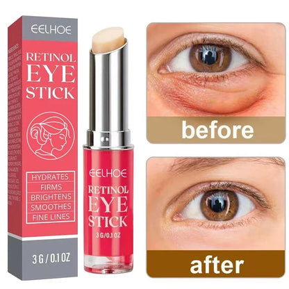 Anti-Wrinkle Retinol Eye Cream - Dark Circle  Puffiness Reducer Firming  Brightening Moisturizer - ZOOMNSTORE