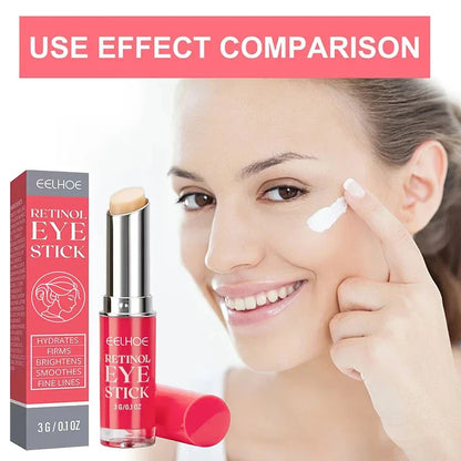 Anti-Wrinkle Retinol Eye Cream - Dark Circle  Puffiness Reducer Firming  Brightening Moisturizer - ZOOMNSTORE