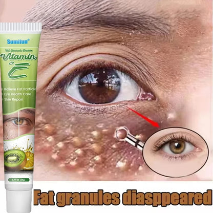 Eye Cream for Fat Granules  Puffiness - Milia Remover  Skin Repair - ZOOMNSTORE