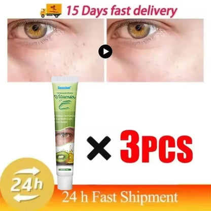 Eye Cream for Fat Granules  Puffiness - Milia Remover  Skin Repair - ZOOMNSTORE