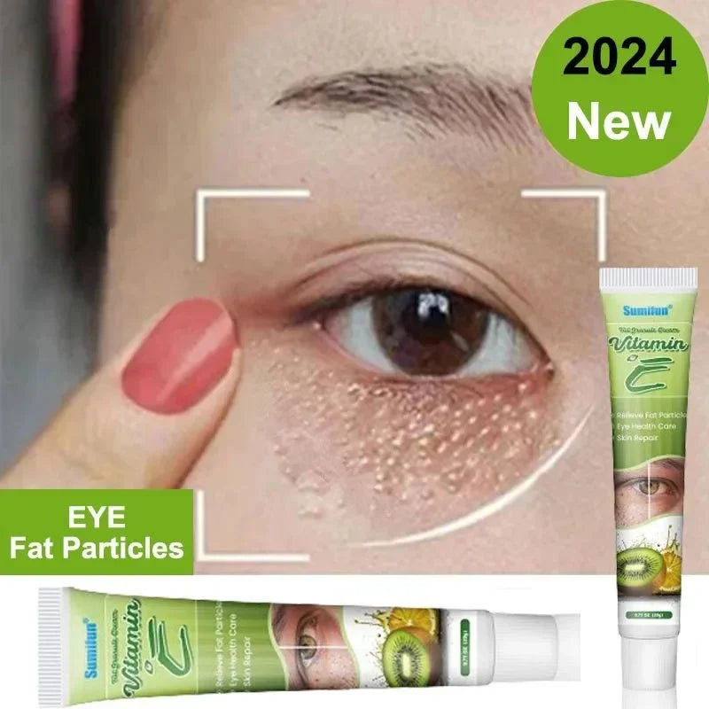 Fat Granules Eye Cream - Skin Care Treatment for Puffiness and Dark Circles - ZOOMNSTORE