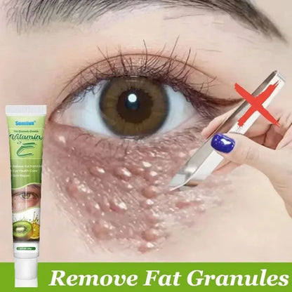 Fat Granules Eye Cream - Skin Care Treatment for Puffiness and Dark Circles - ZOOMNSTORE