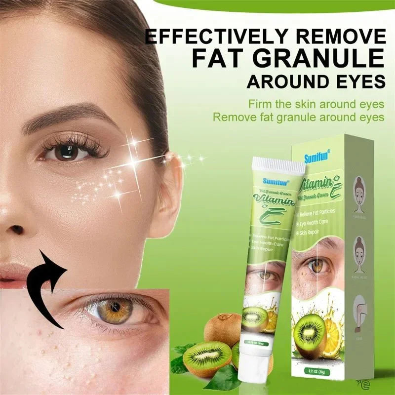 Fat Granules Eye Cream - Skin Care Treatment for Puffiness and Dark Circles - ZOOMNSTORE