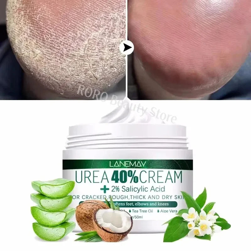 Herbal Foot Cream - Heel Cracking Repair  Dead Skin Exfoliation - ZOOMNSTORE