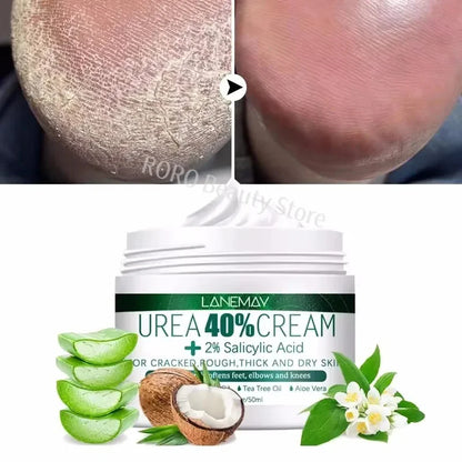 Herbal Foot Cream - Heel Cracking Repair  Dead Skin Exfoliation - ZOOMNSTORE