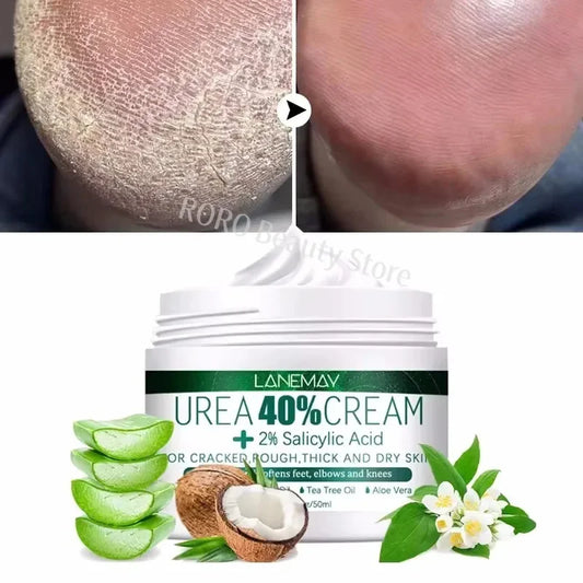 Herbal Foot Cream - Heel Cracking Repair  Dead Skin Exfoliation - ZOOMNSTORE
