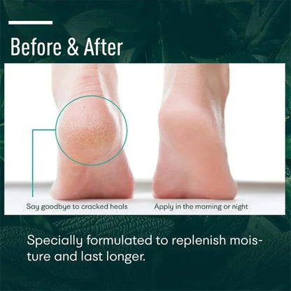 Herbal Foot Cream - Heel Cracking Repair  Dead Skin Exfoliation - ZOOMNSTORE