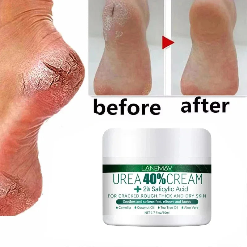 Herbal Foot Cream - Heel Cracking Repair  Dead Skin Exfoliation - ZOOMNSTORE