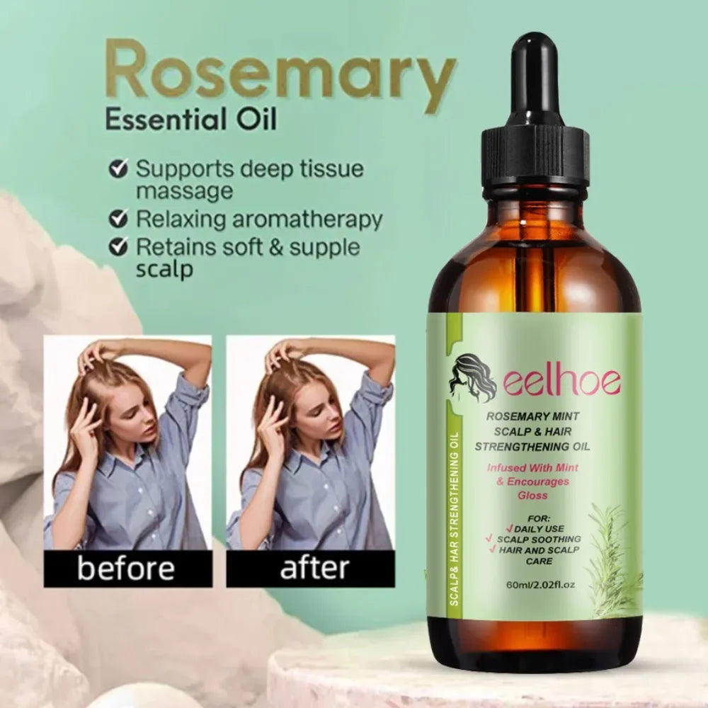 Rosemary Mint Hair Growth Oil - Nourishing Treatment for Dry Ends - ZOOMNSTORE