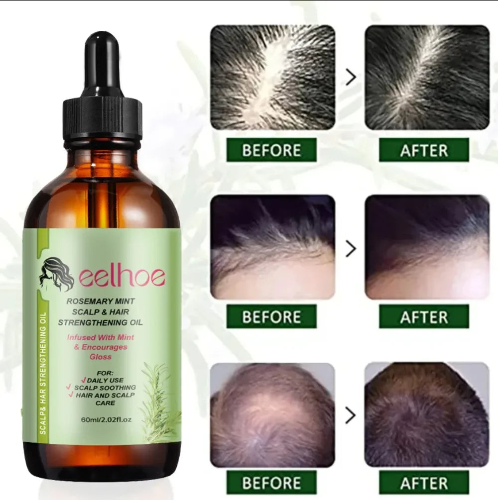 Rosemary Mint Hair Growth Oil - Nourishing Treatment for Dry Ends - ZOOMNSTORE