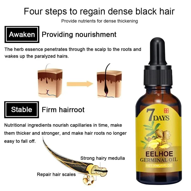 Hair Growth Serum - Ginger Essential Oil for Fast Regrowth  Hair Care 102040ml - ZOOMNSTORE