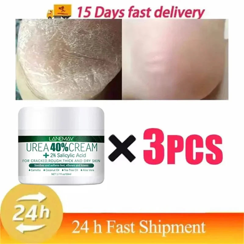 Herbal Foot Cream - Heel Cracking Repair  Dead Skin Exfoliation - ZOOMNSTORE
