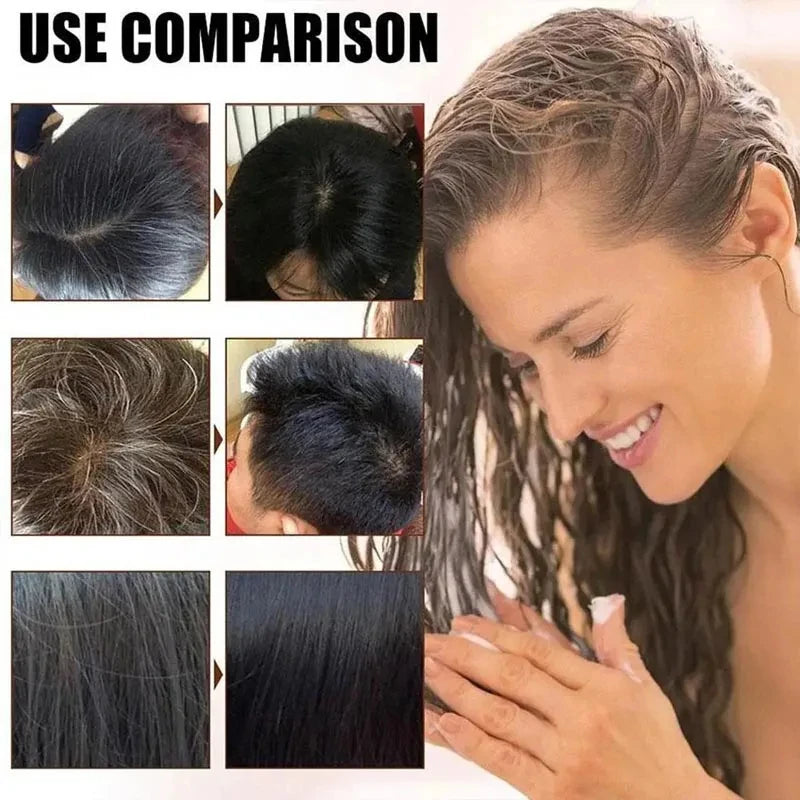 Natural Herbal Hair Dye Shampoo - Gray Coverage  Hair Care Treatment - ZOOMNSTORE