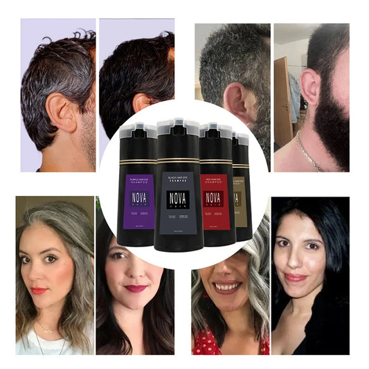 Nova Hair Instant Dye Shampoo - Quick Gray Coverage for Men  Women Nourishing Formula - ZOOMNSTORE