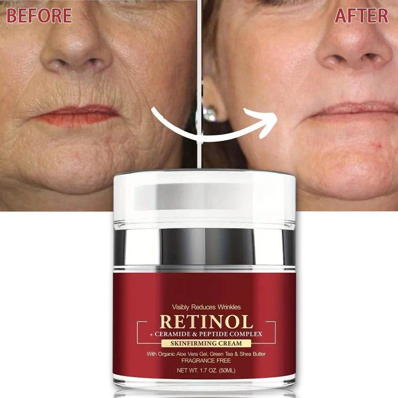 Retinol Anti-Aging Cream - Firming Moisturizer for Fine Lines and Skin Repair - ZOOMNSTORE