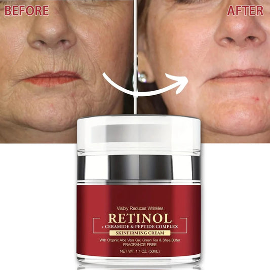 Retinol Anti-Aging Cream - Firming Moisturizer for Fine Lines and Skin Repair - ZOOMNSTORE