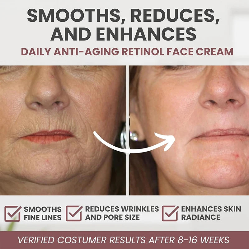 Retinol Anti-Aging Cream - Firming Moisturizer for Fine Lines and Skin Repair - ZOOMNSTORE
