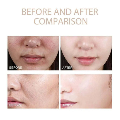 Rice Exfoliating Serum - Hydrating Blackhead Removal  Pore Shrinking Korean Skin Care - ZOOMNSTORE
