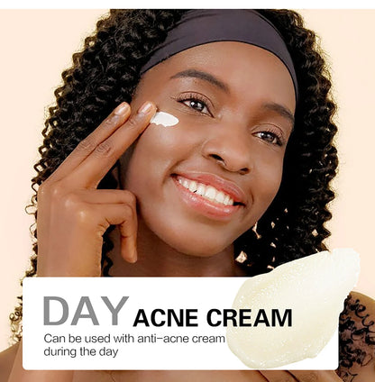 AILKE Natural Turmeric Brightening Face Cream, Glow Boosting, Skin Moisturizer, Anti-Acne Facial Cream, for All Skin Tone