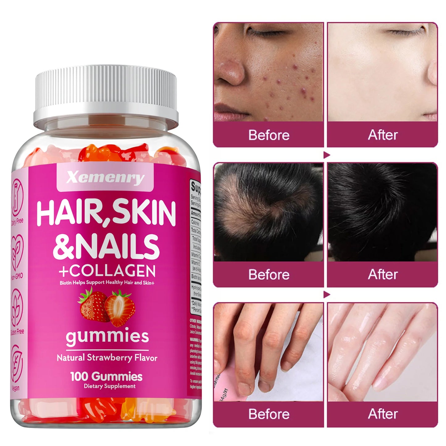 High Potency Biotin Gummies - for Healthy Hair, Skin & Nails, Hair Vitamins for Men & Women | Gluten Free