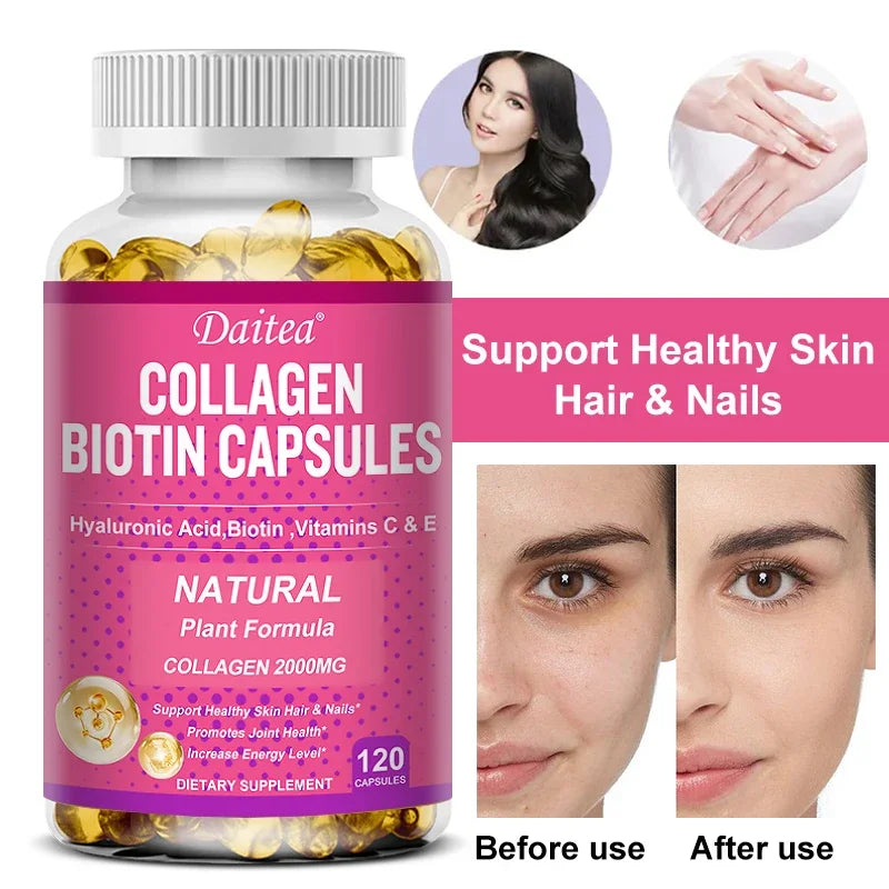 Collagen Biotin Supplement - Hyaluronic Acid Biotin Vitamin C E - Hair Skin Nails Joint Support and Energy Boost Vegan Capsules