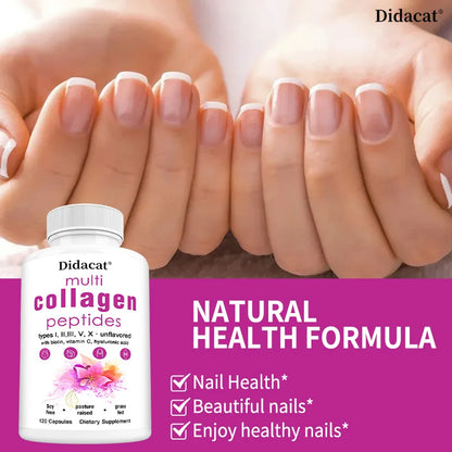 Multi-collagen Peptides - Anti-aging, Brightening Skin Tone, Firming Skin, Hair, Nail, Skin, and Joint Health Supplements