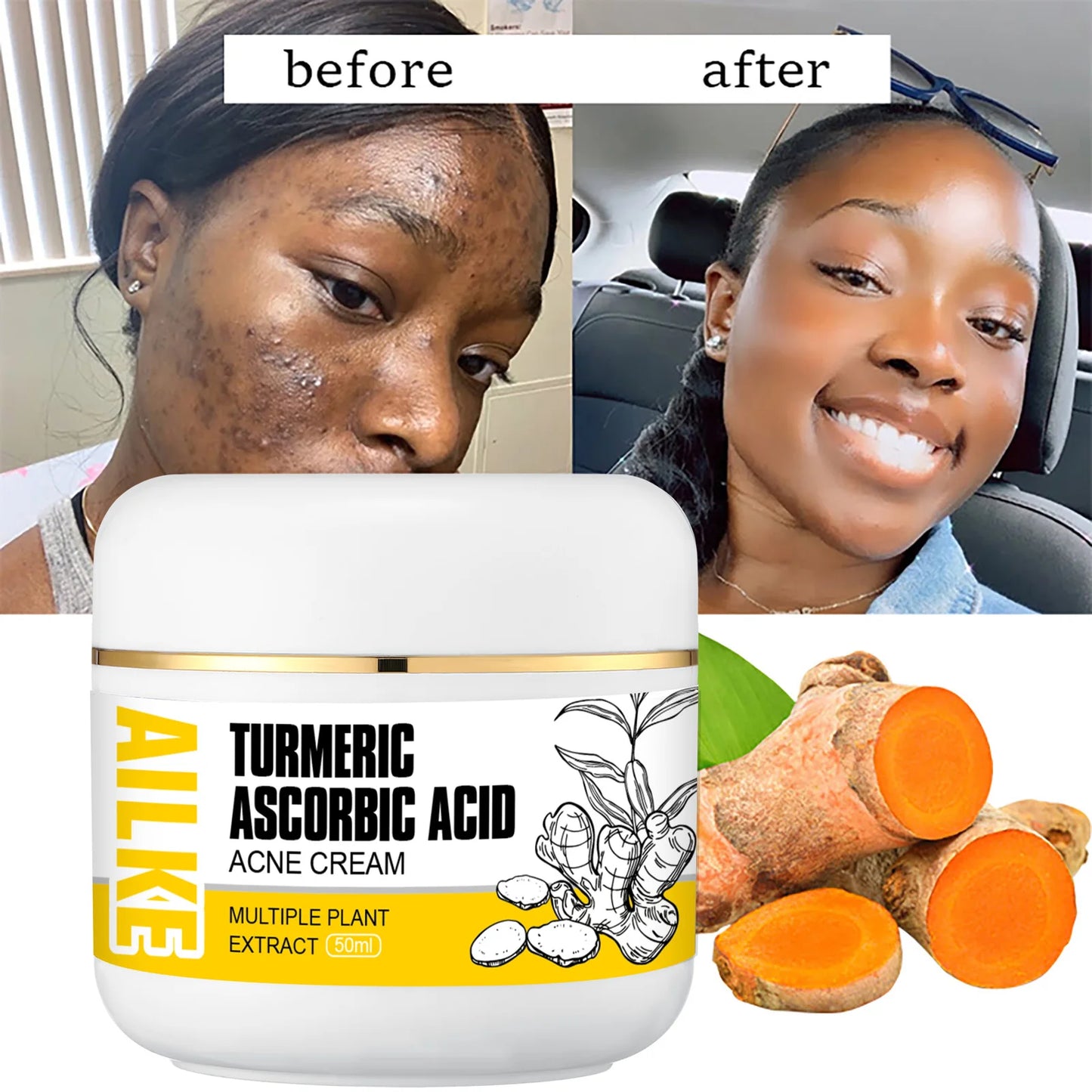 AILKE Natural Turmeric Brightening Face Cream, Glow Boosting, Skin Moisturizer, Anti-Acne Facial Cream, for All Skin Tone