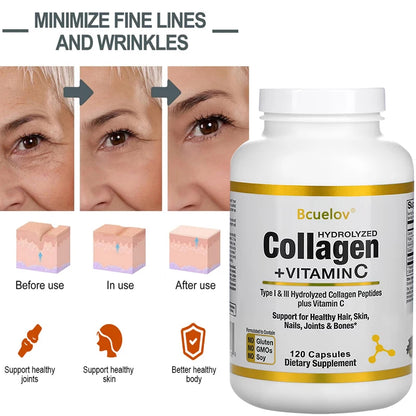 Hydrolyzed Collagen Peptides + Vitamin C, Types I & III Support Healthy Hair, Skin, Nails, Joints & Bones Boosts Immunity