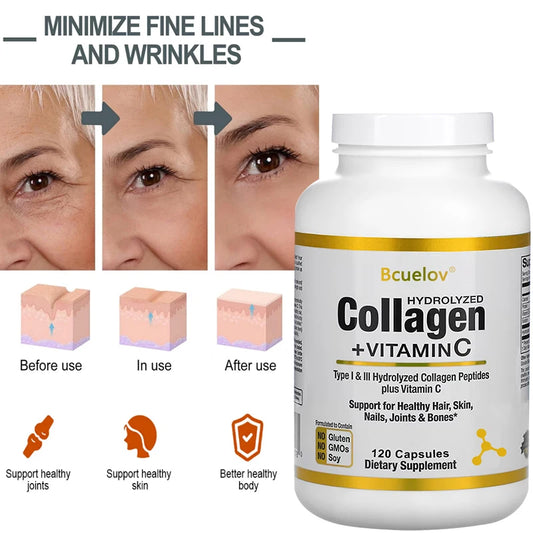 Hydrolyzed Collagen Peptides + Vitamin C, Types I & III Support Healthy Hair, Skin, Nails, Joints & Bones Boosts Immunity