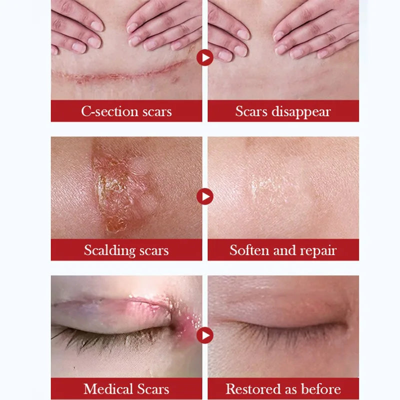 Scar Repair Cream - Moisturizing Rejuvenating Facial Skin Care for Women - ZOOMNSTORE