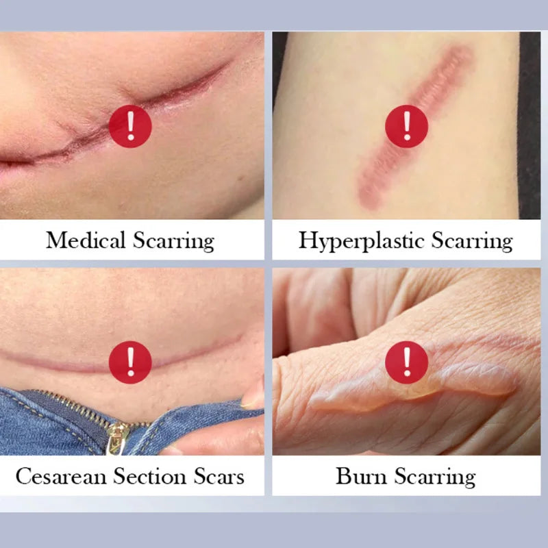 Scar Repair Cream - Moisturizing Rejuvenating Facial Skin Care for Women - ZOOMNSTORE