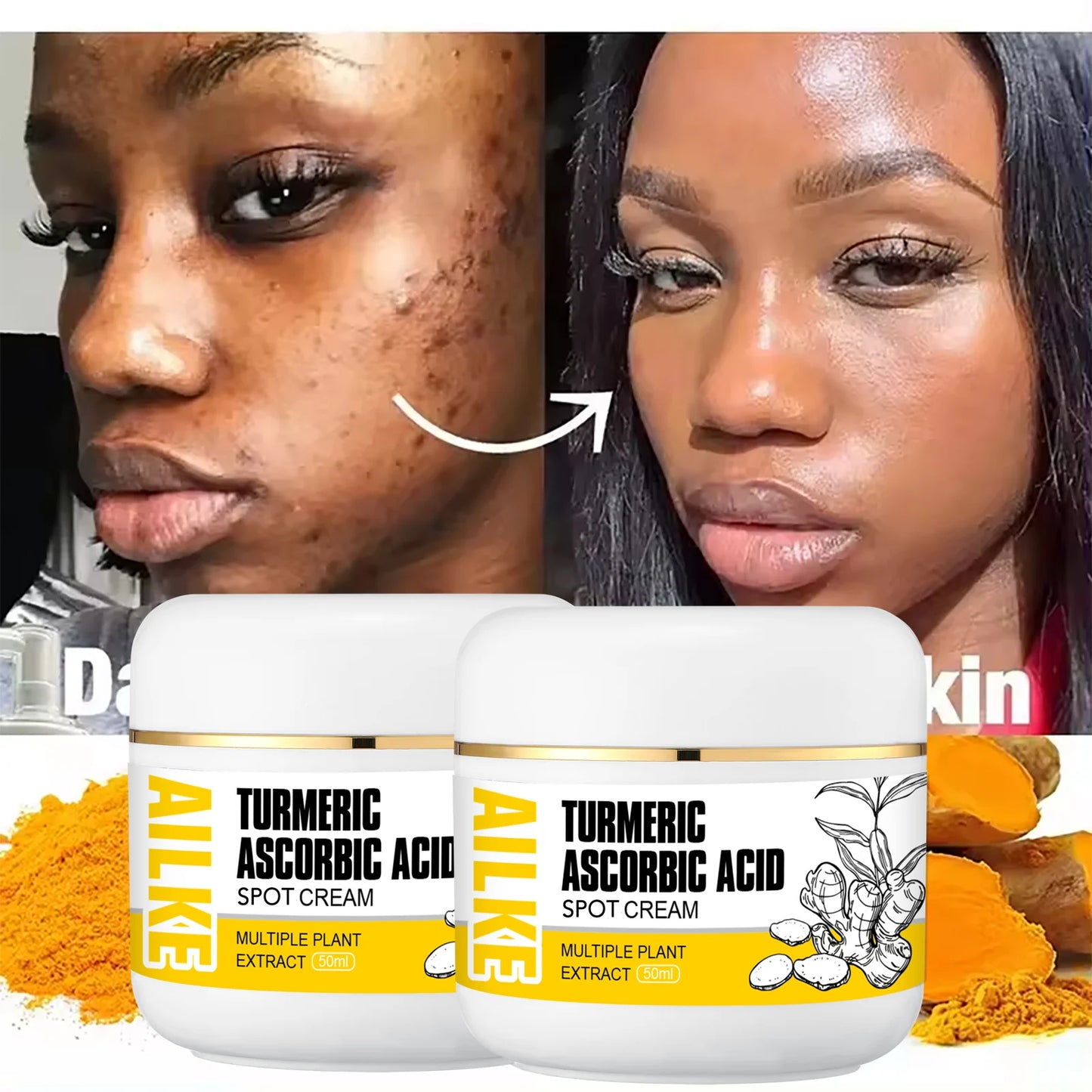 AILKE Natural Turmeric Brightening Face Cream, Glow Boosting, Skin Moisturizer, Anti-Acne Facial Cream, for All Skin Tone