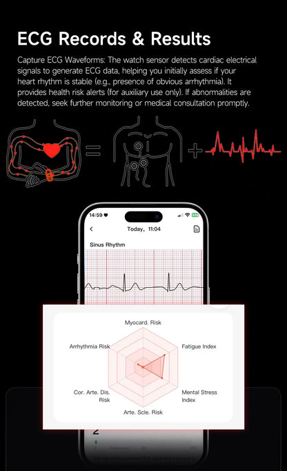 New No Screen Health Bracelet Precise Heart Rate Blood Pressure ECG Monitor Call Reminder Smart Watch Sport Band Fitness Tracker