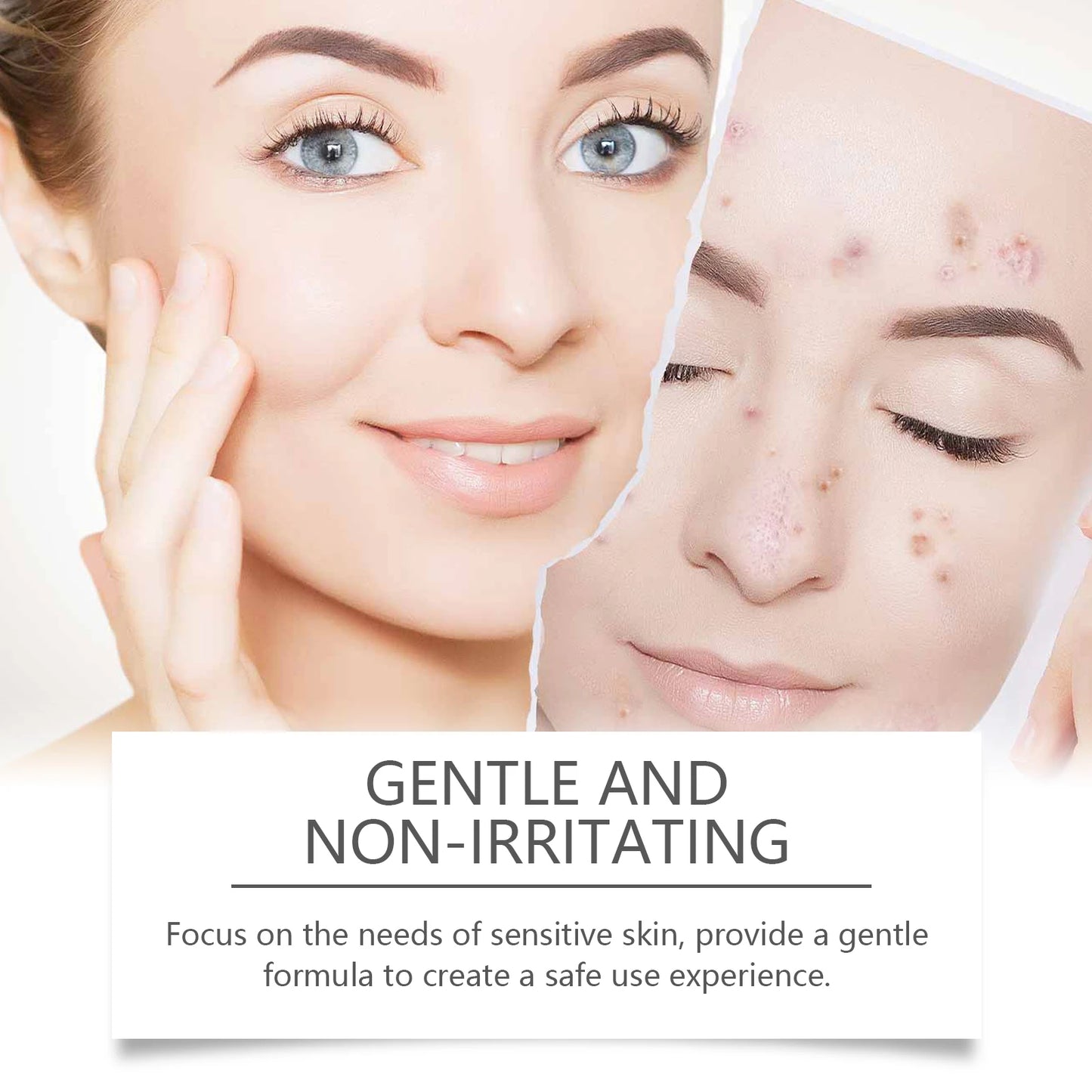 Salicylic Acid Facial Cleanser Acne Treatment Moisturizing Oil Control Skincare Face Wash Cleansing Pore Hydrating Skin Care