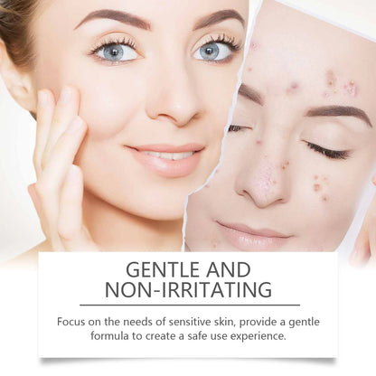 Salicylic Acid Facial Cleanser Acne Treatment Moisturizing Oil Control Skincare Face Wash Cleansing Pore Hydrating Skin Care