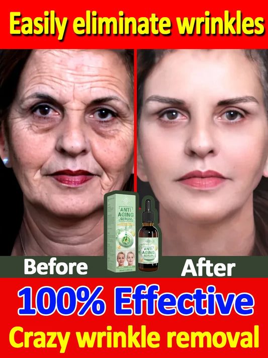Wrinkle-Reducing Beauty Serum - Best Choice for Beauty Lovers - ZOOMNSTORE