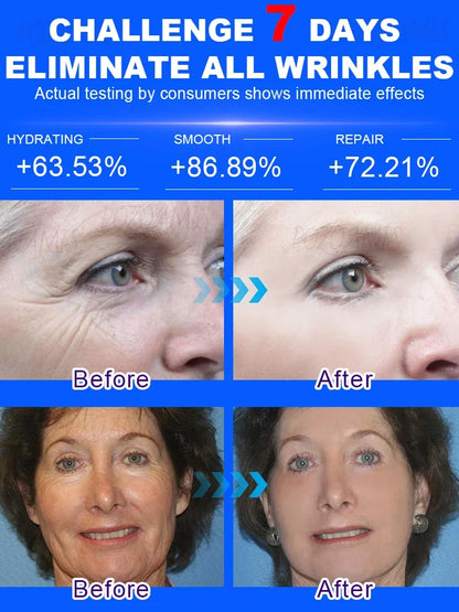 Wrinkle-Reducing Beauty Serum - Best Choice for Beauty Lovers - ZOOMNSTORE