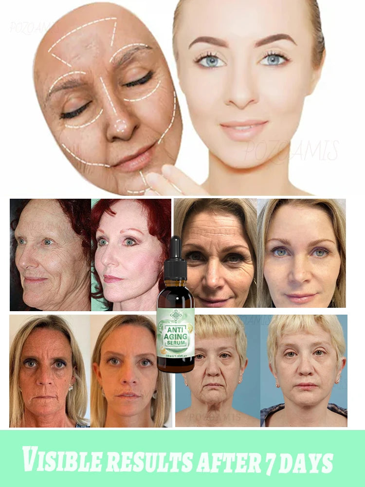 Wrinkle-Reducing Beauty Serum - Best Choice for Beauty Lovers - ZOOMNSTORE